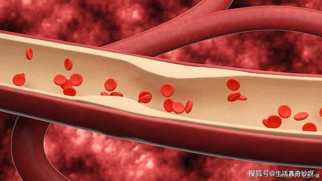 武汉大学发现：不吃大蒜和辣椒的人，血栓一下就不堵了？可信吗 血管健康的“隐形卫士”